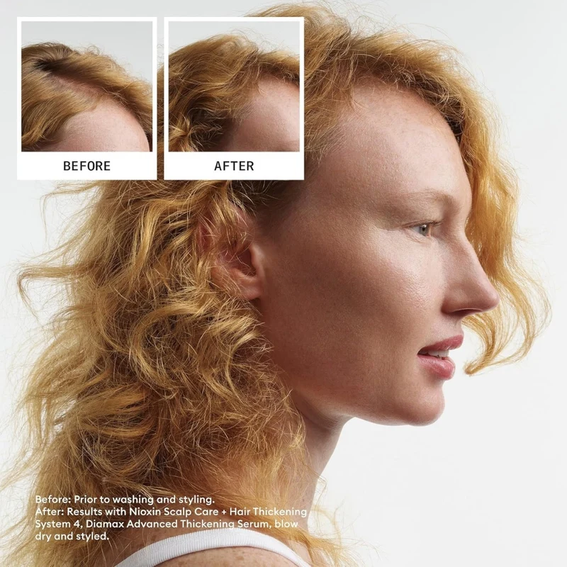 Trio shampoing, revitalisant et traitement sans rinçage cheveux + cuir chevelu Système 4 - Pour cheveux colorés avec chute avancée (2x 300ml/10.1oz, 100ml/3.38oz)