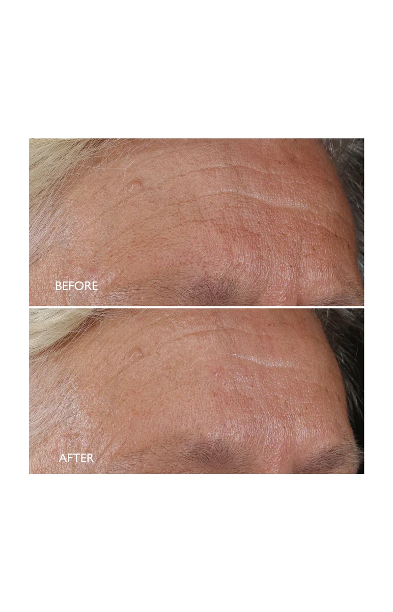 Crème de nuit régénérante - Age Benefit - Lotus - Visage - 50 ml