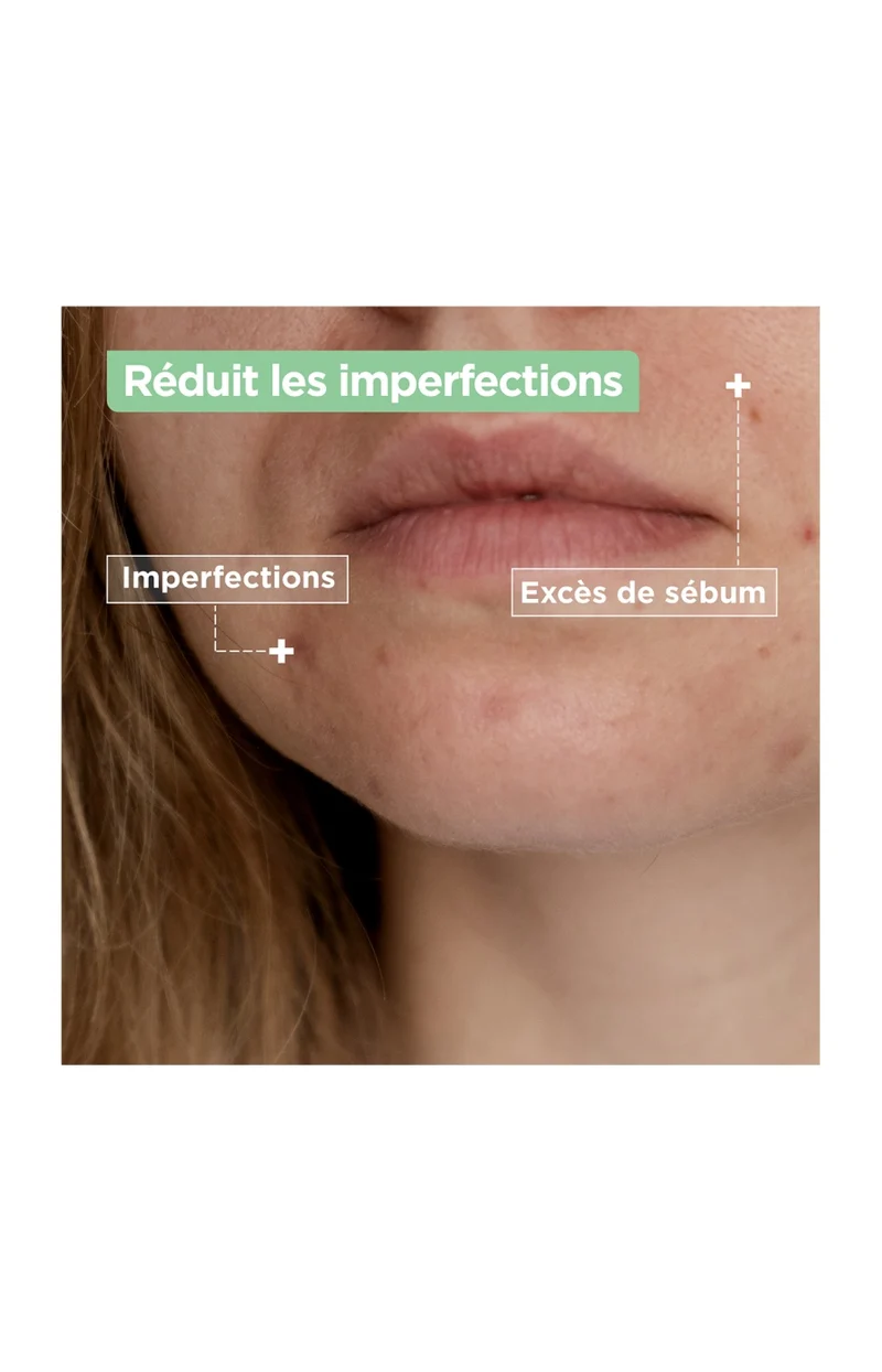 Gel nettoyant anti-imperfections - Acide salicylique & squalane - Peaux mixtes à grasses - 200 ml